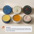 Norse Organics - Kill Acne & Redness Ritual