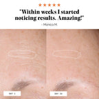 Froya Organics Anti-Age & Insane Glow Day Balm