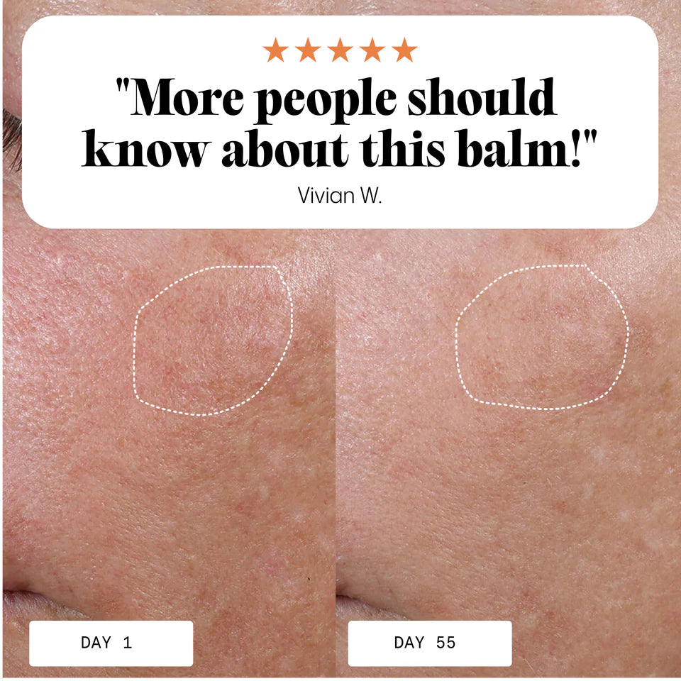 Froya Organics Anti-Age & Insane Glow Day Balm