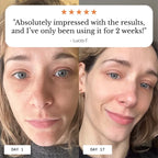 FROYA ORGANICS - Hyper Potent Dark Circles & Bag Eye Balm