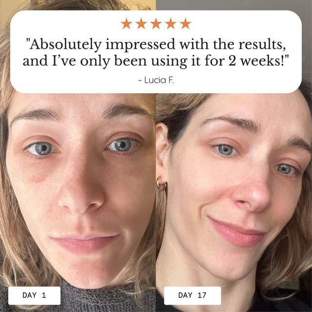 FROYA ORGANICS - Hyper Potent Dark Circles & Bag Eye Balm