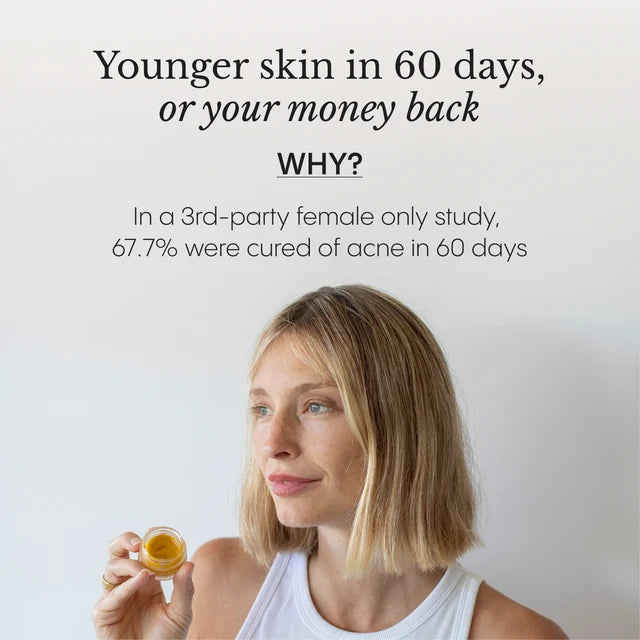 FROYA ORGANICS - Hyper Potent Dark Circles & Bag Eye Balm
