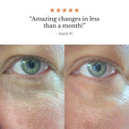 FROYA ORGANICS - Hyper Potent Dark Circles & Bag Eye Balm