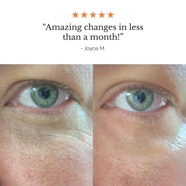 FROYA ORGANICS - Hyper Potent Dark Circles & Bag Eye Balm