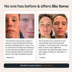 norse organics - Scrub for Acne-Prone Skin