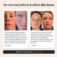 norse organics - Scrub for Acne-Prone Skin