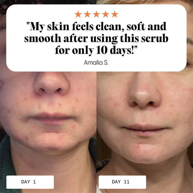 FROYA ORGANICS - Ultra Cleanse & Revive Face Scrub